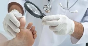 Полезная справка для пациентов: симптомы грибка ногтей на ногах